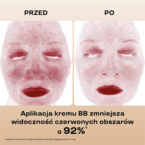 Nawilżający krem BB SPF 15, Wyrównanie i Łagodzenie, 210/Beige